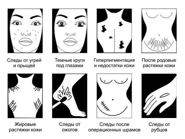 Крем Пранайва Призтин (для проблемной кожи) (25 г)